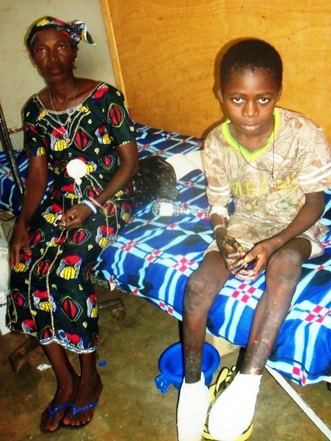 Hôpital de Gaoua : Le ministre de la femme a rendu visite à l’enfant amputé Roland Somé